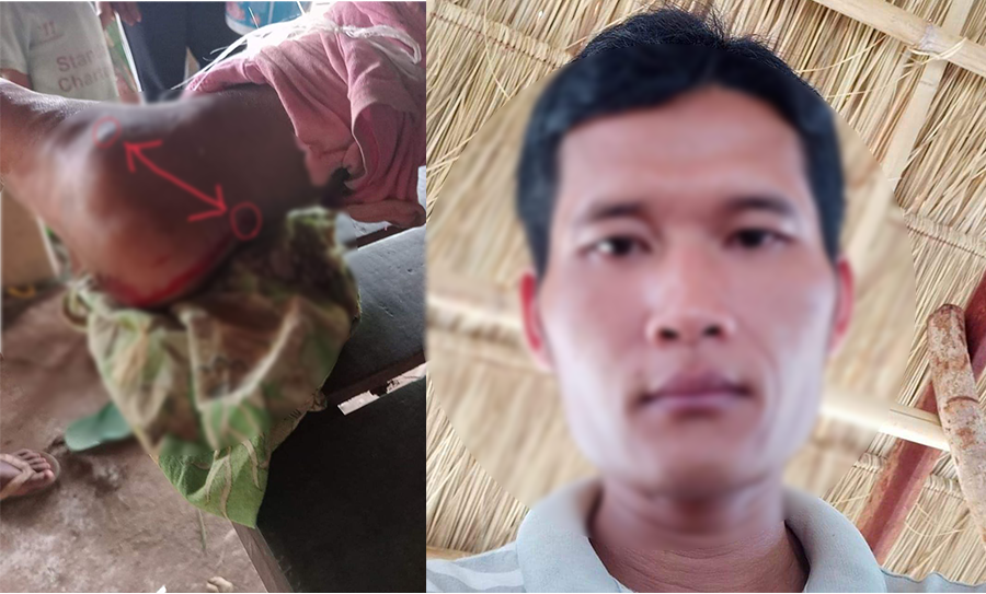 ករណីបង្ហោះ facebook ល្បីថាមានសត្វក្រពើខាំបុរសម្នាក់ នៅអន្លង់ឈើទាលព្រះរំកិល ខេត្តស្ទឹងត្រែង ការពិតជាករណីសត្វបបែលចុកសោះ
