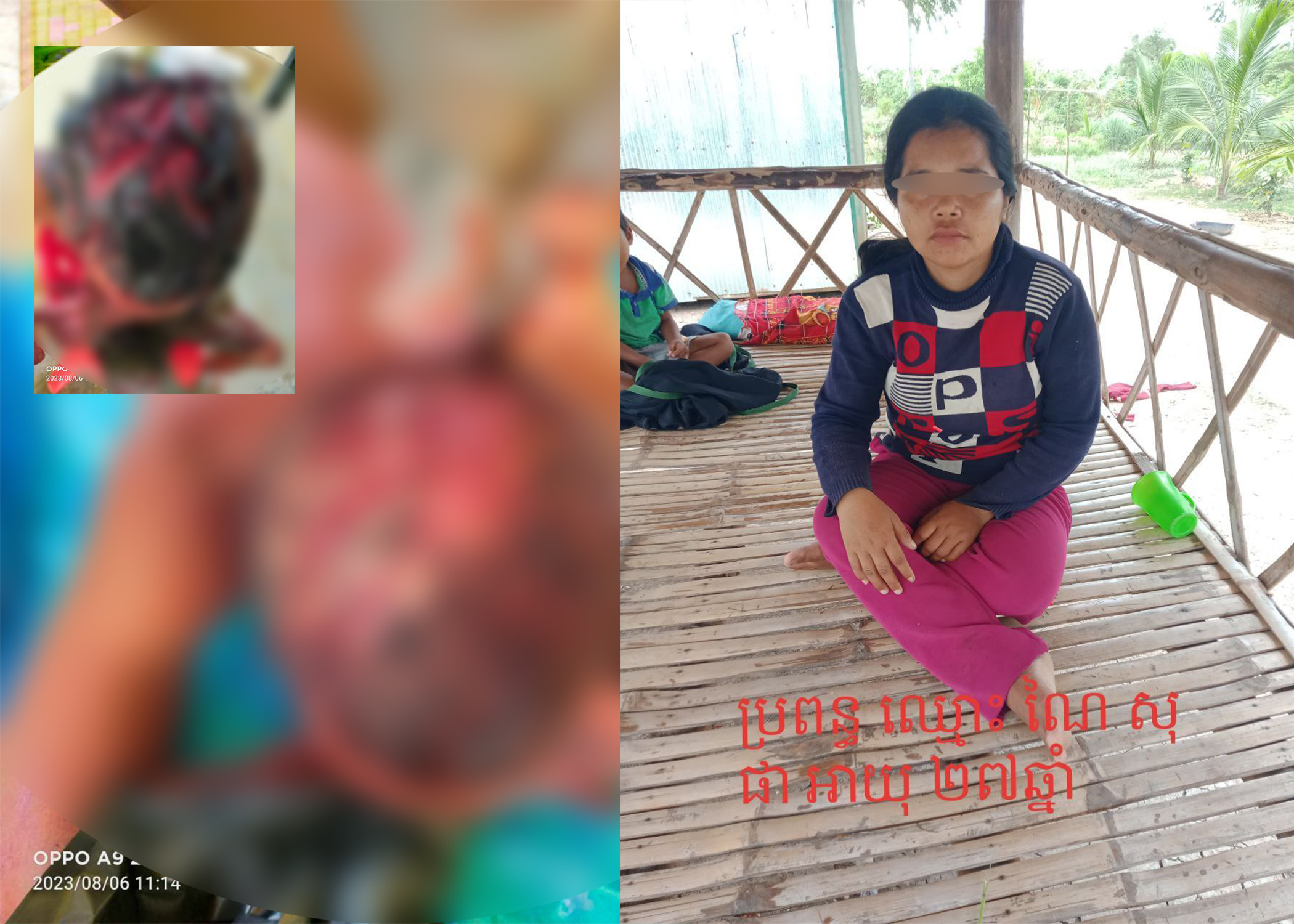 ភ្លើងប្រចណ្ឌ! ខឹងដើររកប្រពន្ធអត់ឃើញ និងចោទប្រកាន់ថា “ស្កាត់ទៅរកជួបសាហាយស្មន់” បុរសម្នាក់យកកាំបិតប៉័ងតោកាប់ក្បាលខ្លួនឯងផ្អើលអ្នកភូមិ