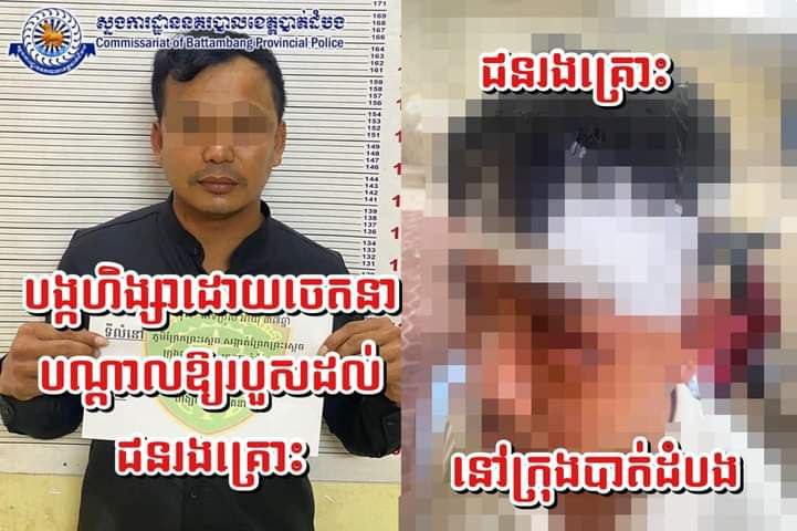 ផឹកស៊ីជុំគ្នាផ្ទុះកំហឹងក្លាយជាហិង្សាបណ្តាលឱ្យភាគីម្ខាងរងរបួសធ្ងន់ត្រូវបានសមត្ថកិច្ចនគរបាលក្រុងបាត់ដំបងឃាត់ខ្លួន