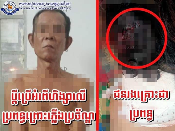 អុញនោះ! ព្រោះតែភ្លើងប្រច័ណ្ឌ បានធ្វើឱ្យបុរសជាប្តីប្រើប្រាស់កាំបិតកាប់ជាច្រើនកាំបិតទៅលើភរិយាបណ្តាលឱ្យរងរបួសធ្ងន់ នៅស្រុកថ្មគោល