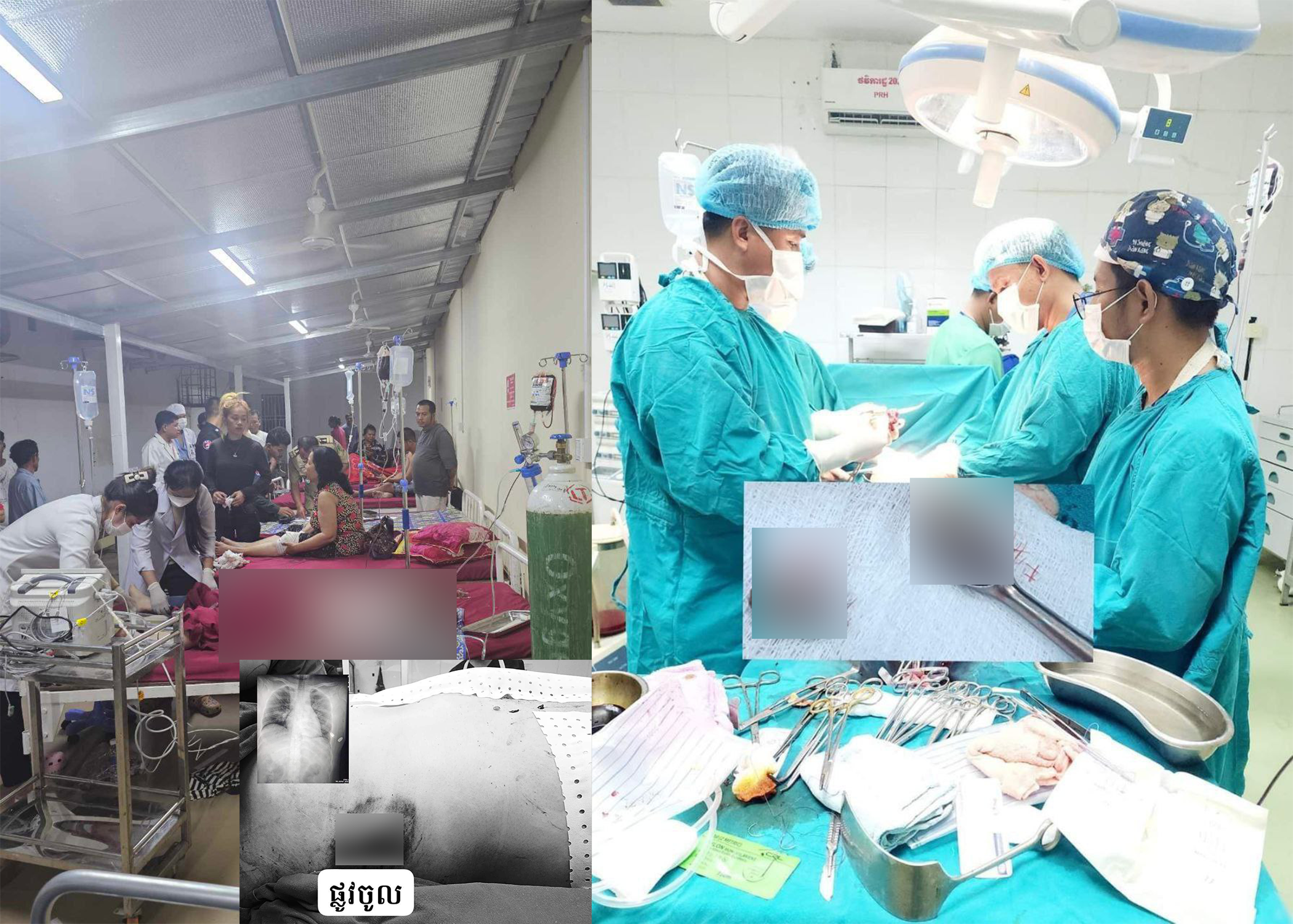 Update: ករណីខ្មាន់កាំភ្លើងចូលបាញ់ប៉ុនប៉ងសម្លាប់មនុស្សមួយគ្រួសារកក្រើកក្រុងពោធិ៍សាត់ដល់ក្នុងផ្ទះបណ្តាលឱ្យរងរបួស ចំនួន ០៣នាក់ សមត្ថកិច្ចសន្នដ្ឋាជារឿងគំនុំ មុខសញ្ញាមិនទាន់កំណត់បាននៅឡើយ!